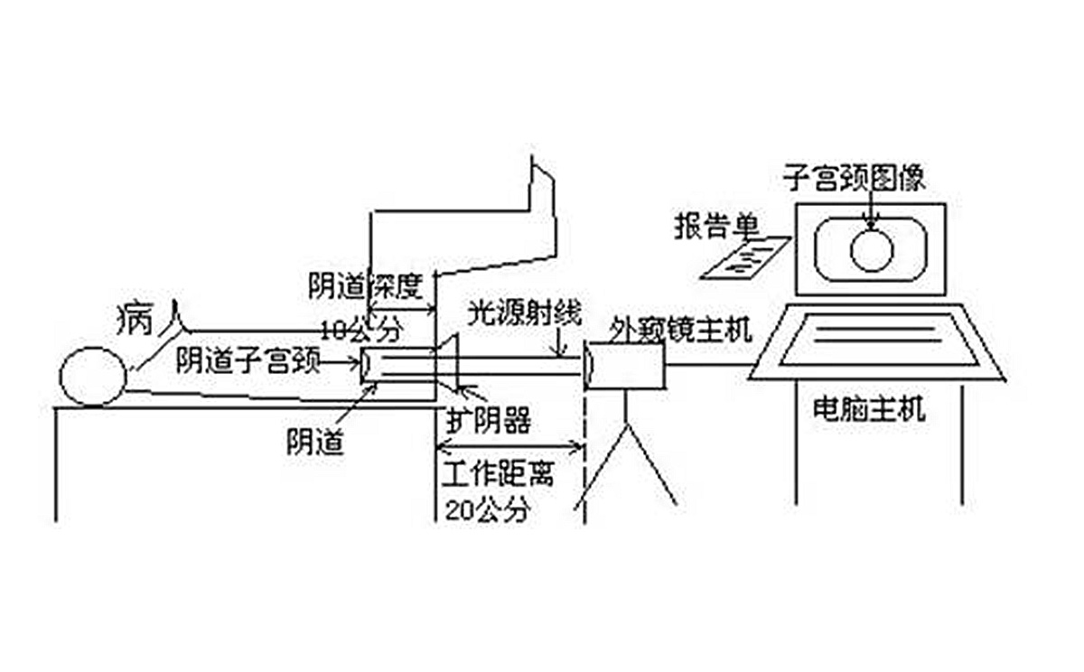 如何使用數(shù)碼電子陰道鏡? 如何使用數(shù)碼電子陰道鏡?