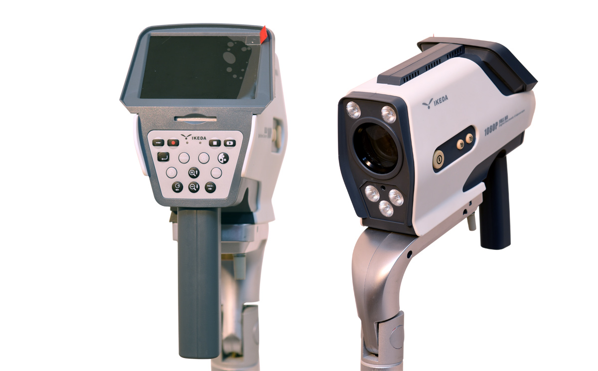 數碼電子陰道鏡攝像機特點 數碼電子陰道鏡攝像機特點