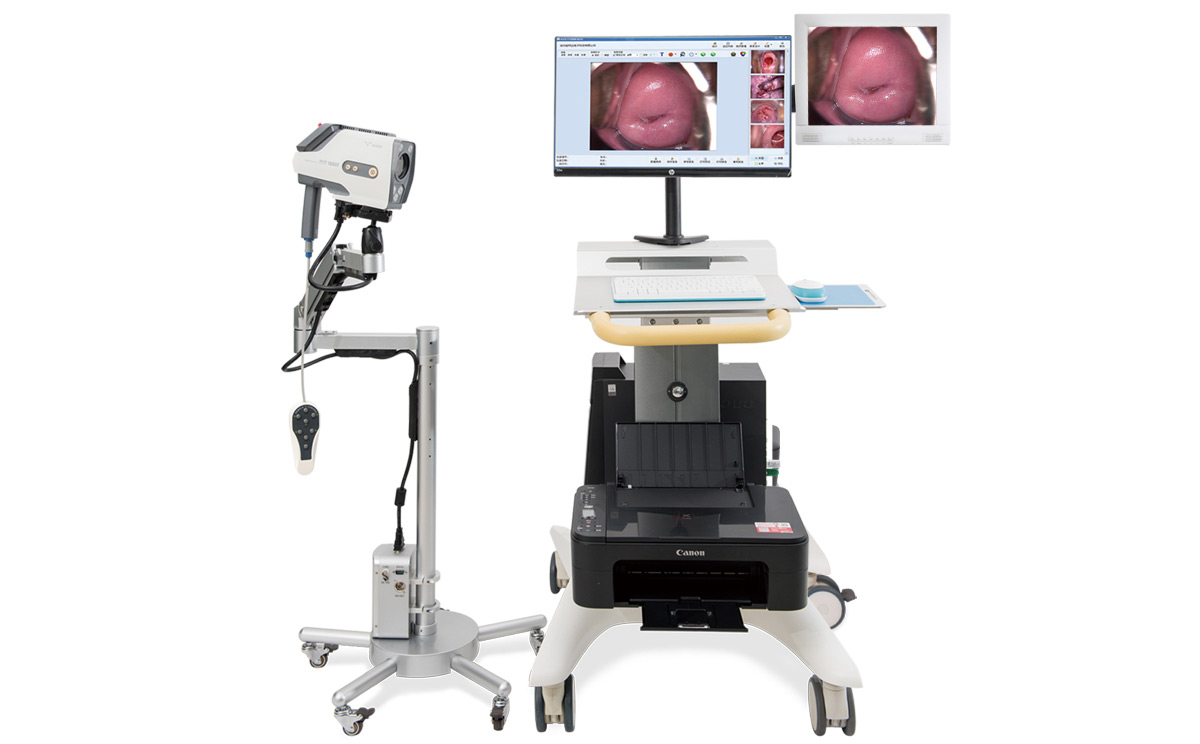 如何選擇數碼電子陰道鏡? 如何選擇數碼電子陰道鏡?