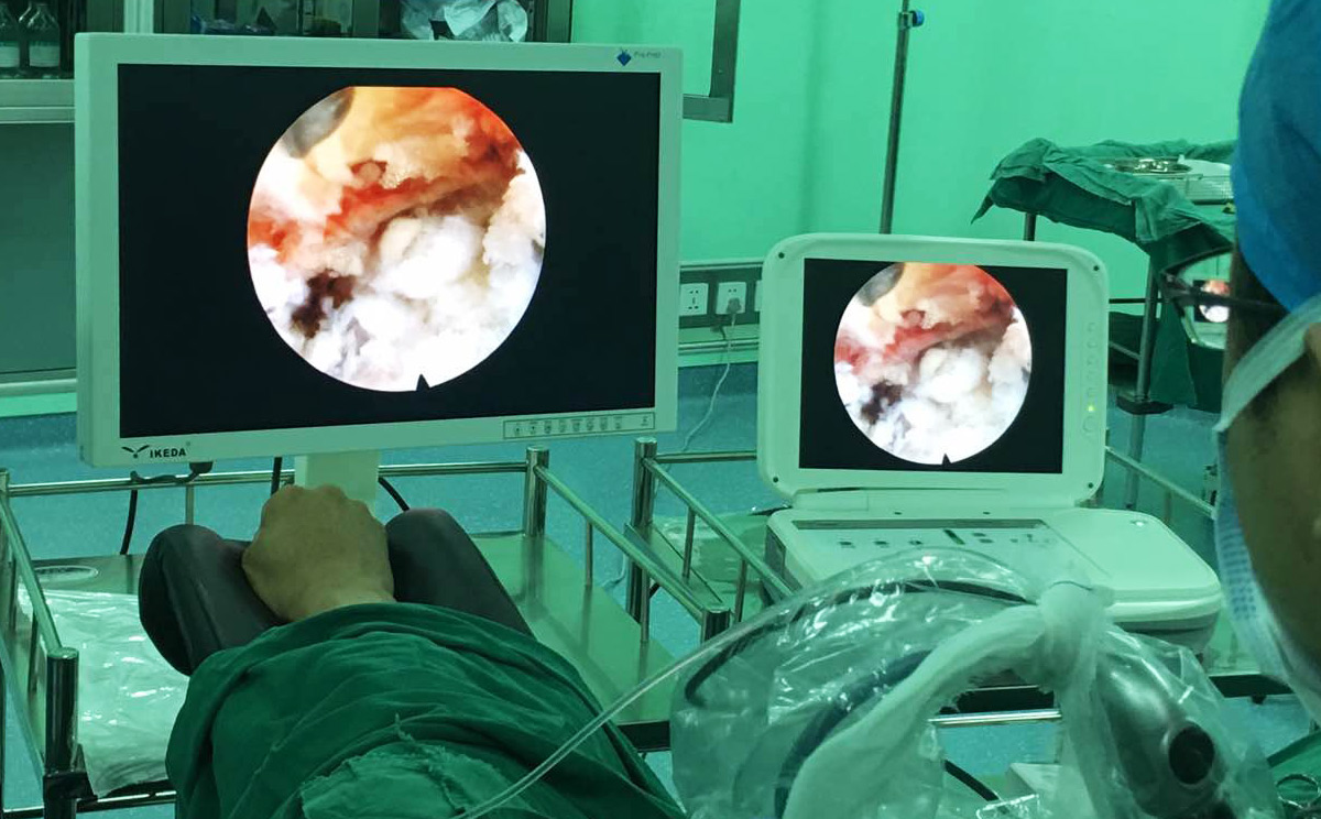 如何維護(hù)保養(yǎng)內(nèi)窺鏡顯示器? 如何維護(hù)保養(yǎng)內(nèi)窺鏡顯示器?