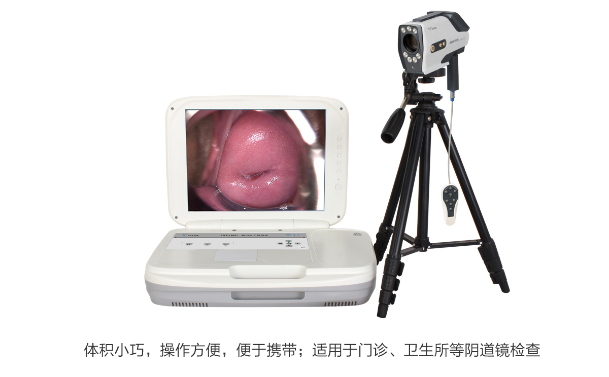 便攜式電子陰道鏡的特點 便攜式電子陰道鏡的特點