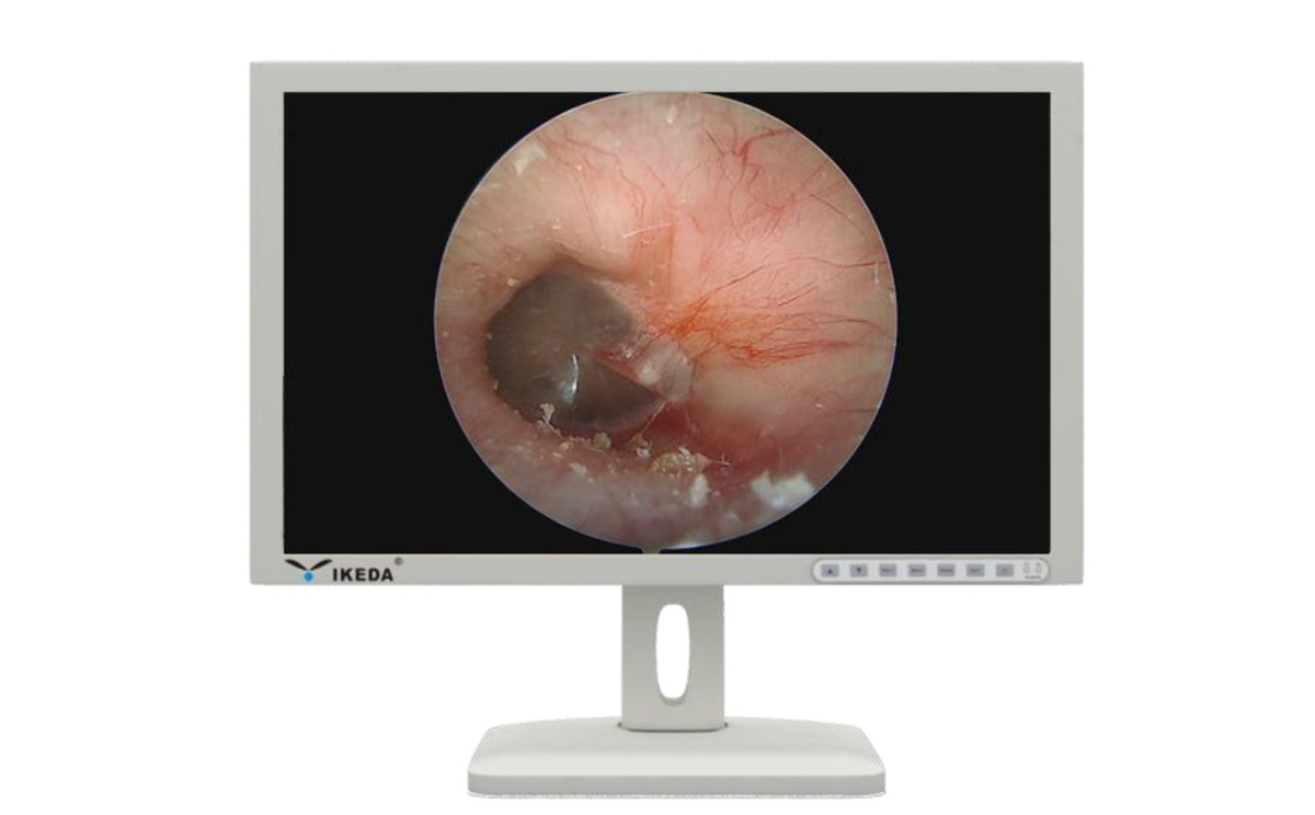 內窺鏡監視器功能特點 內窺鏡監視器功能特點