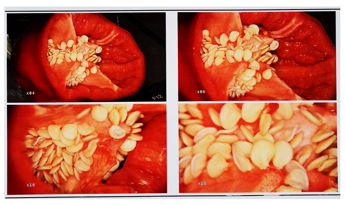 電子陰道鏡放大倍率是多少? 電子陰道鏡放大倍率是多少?