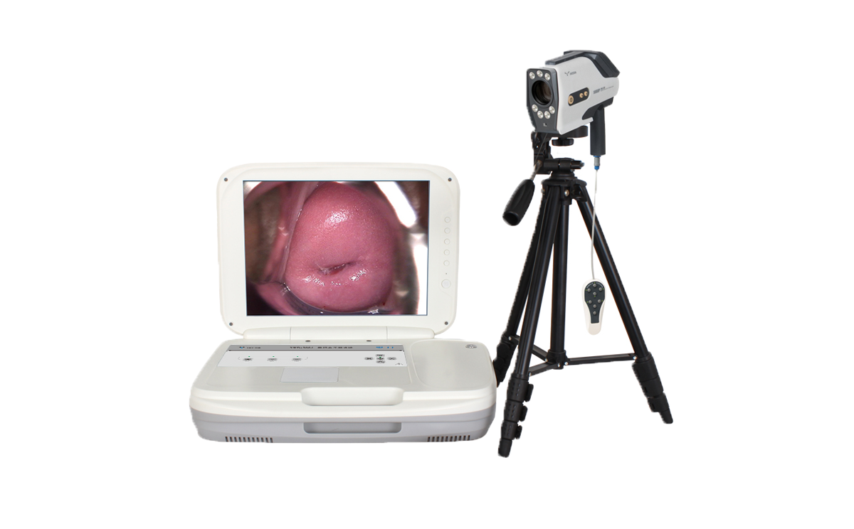 數(shù)碼電子陰道鏡如何選擇?根據(jù)醫(yī)院等級需求選擇合適的 數(shù)碼電子陰道鏡如何選擇?根據(jù)醫(yī)院等級需求選擇合適的