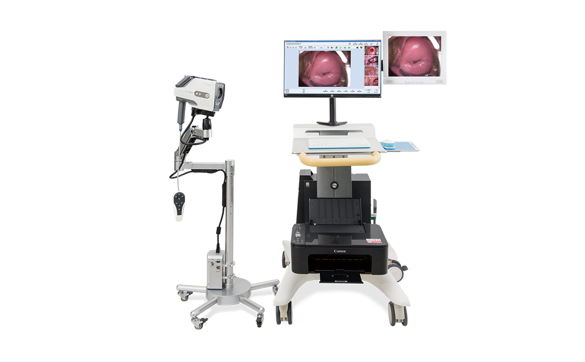 數(shù)碼電子陰道鏡如何選擇?根據(jù)醫(yī)院等級需求選擇合適的 數(shù)碼電子陰道鏡如何選擇?根據(jù)醫(yī)院等級需求選擇合適的