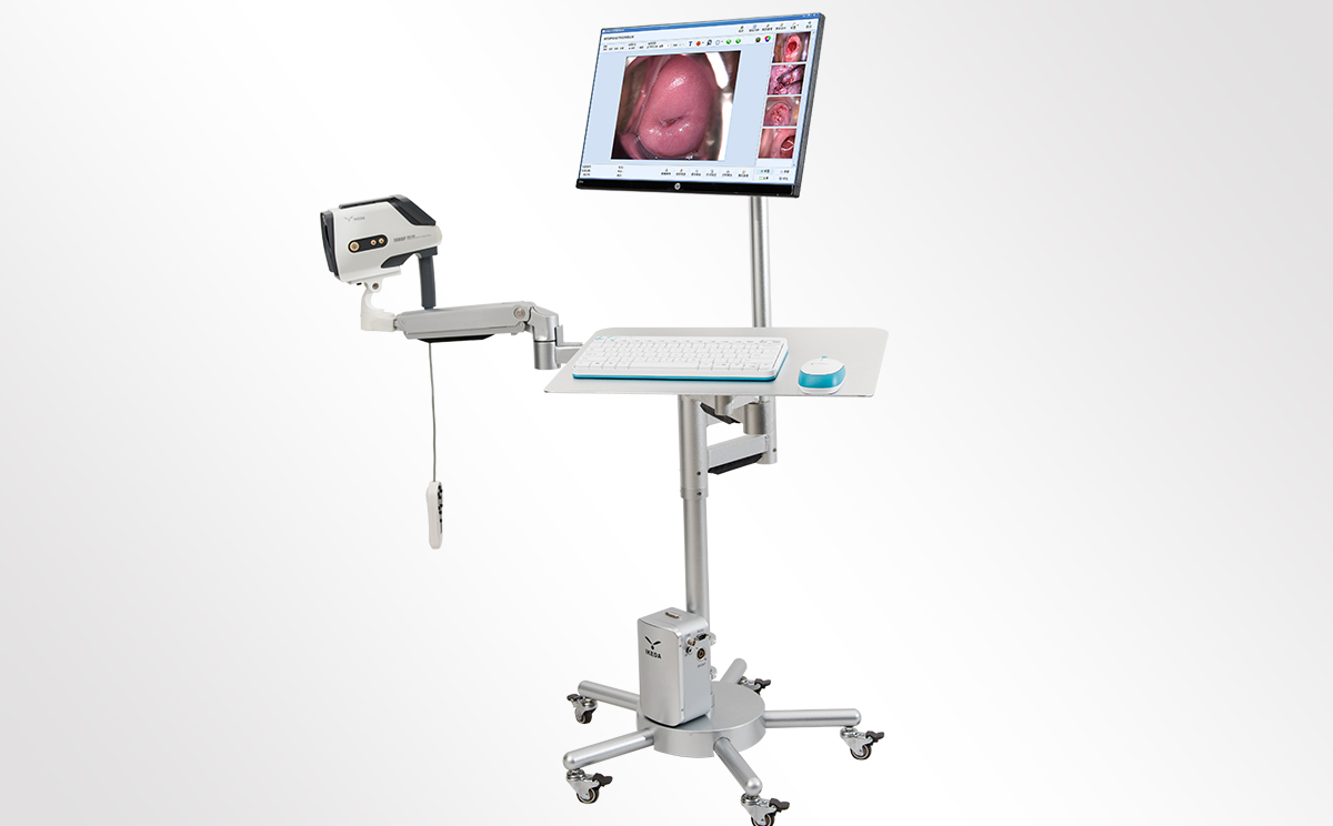 陰道鏡廠家：哪里可以買到陰道鏡？陰道鏡價(jià)格？