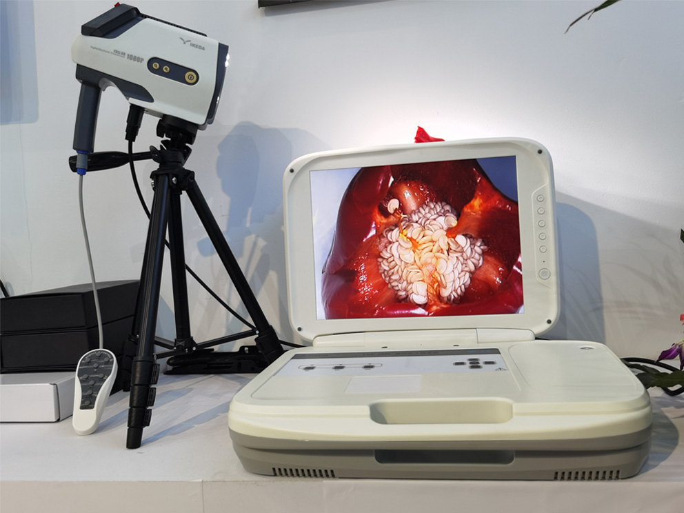 陰道鏡檢查:電子陰道鏡檢查過程疼嗎? 陰道鏡檢查:電子陰道鏡檢查過程疼嗎?