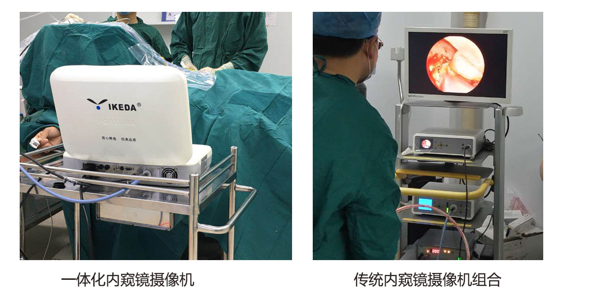 什么是一體化內窺鏡攝像機? 什么是一體化內窺鏡攝像機?