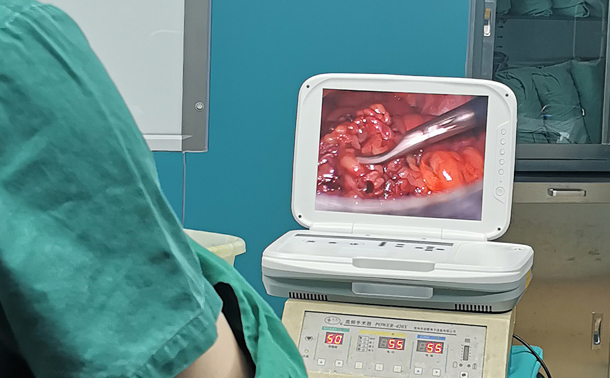 【腹腔鏡篇】腹腔鏡疝氣手術,您知道嗎? 【腹腔鏡篇】腹腔鏡疝氣手術,您知道嗎?