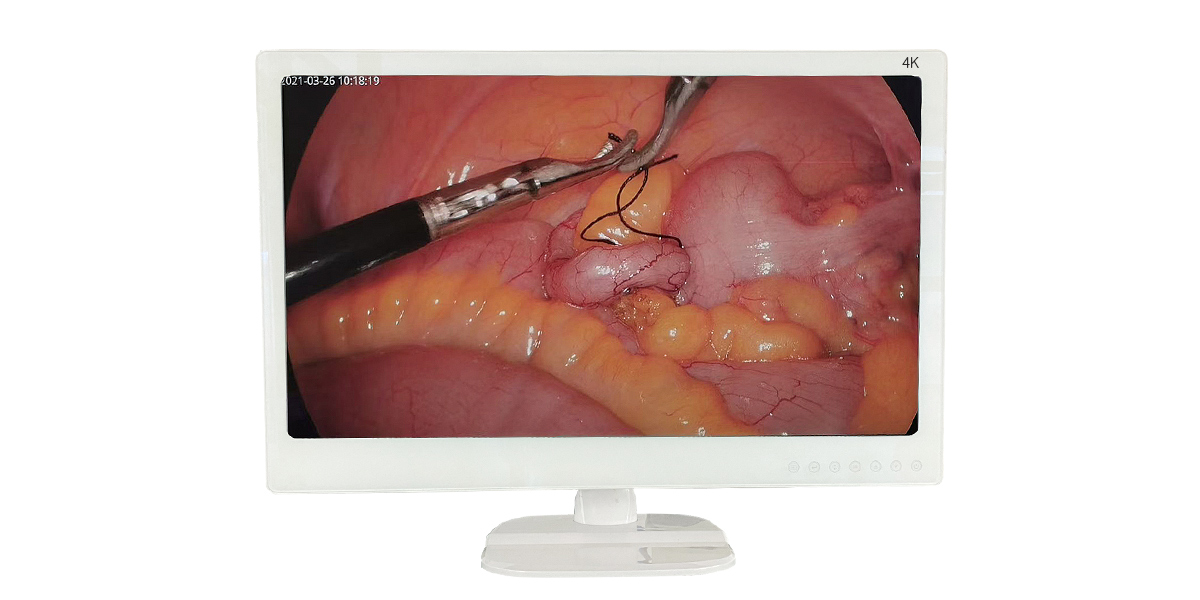 內(nèi)窺鏡監(jiān)視器日常維護(hù)保養(yǎng)應(yīng)注意哪些? 內(nèi)窺鏡監(jiān)視器日常維護(hù)保養(yǎng)應(yīng)注意哪些?