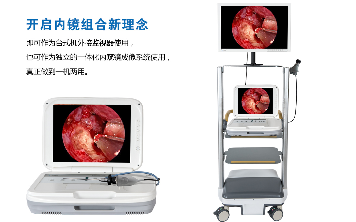 用戶反饋:YKD-9003內窺鏡攝像機獲得好評 用戶反饋:YKD-9003內窺鏡攝像機獲得好評
