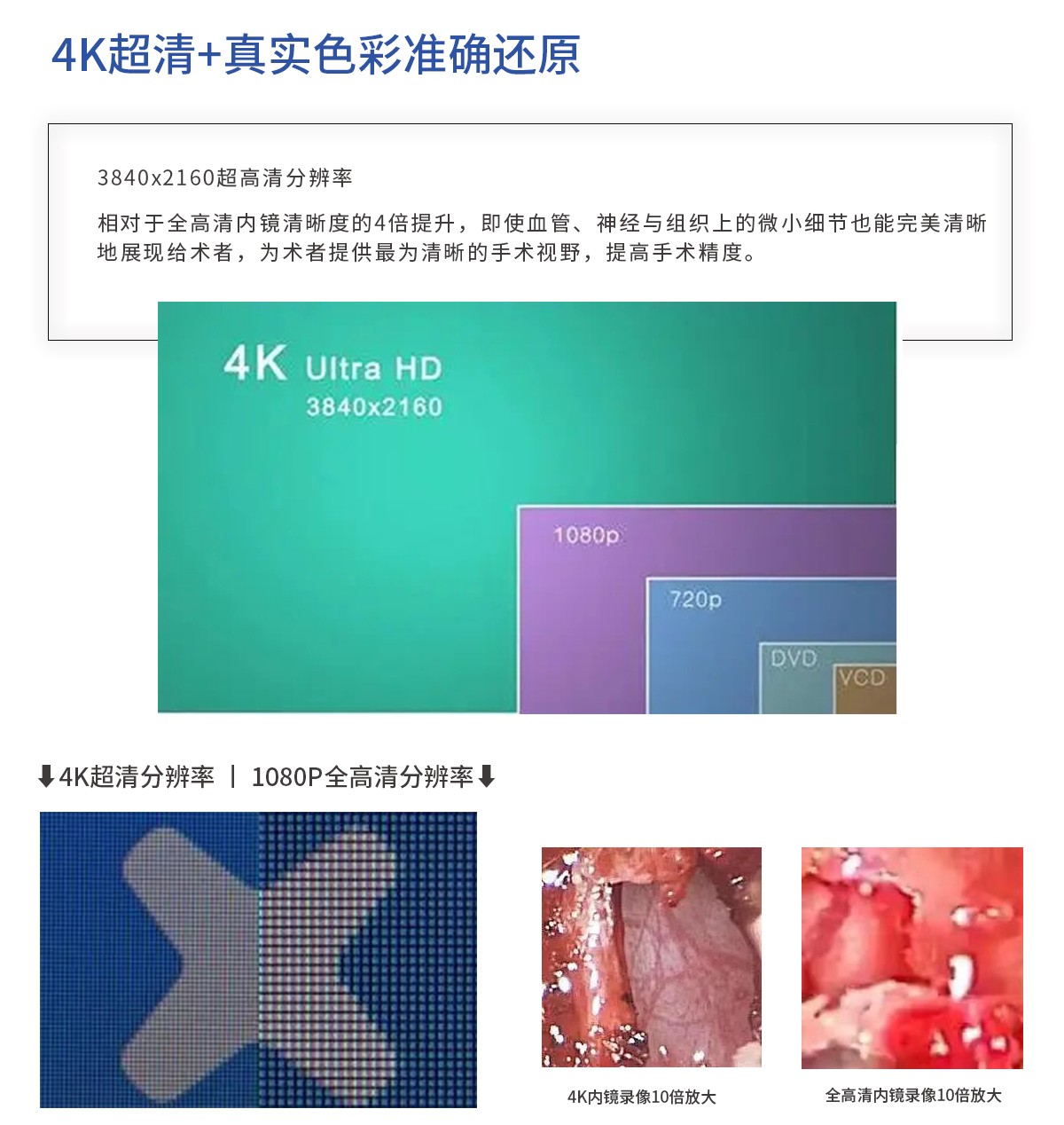 【4K醫用內窺鏡攝像系統】您的第一臺“4K”找到了嗎？