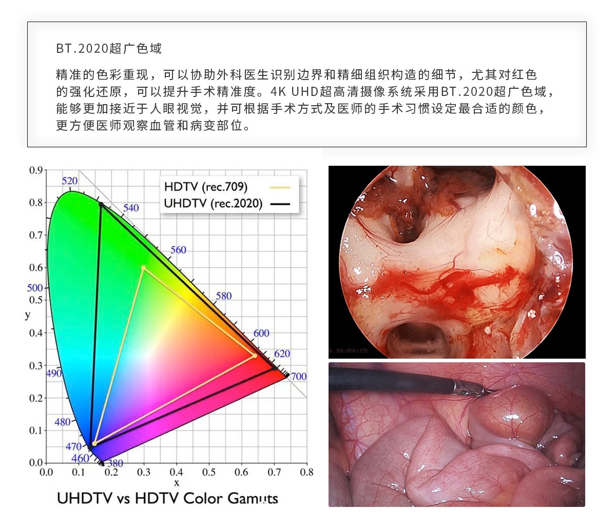 【4K醫用內窺鏡攝像系統】您的第一臺“4K”找到了嗎？