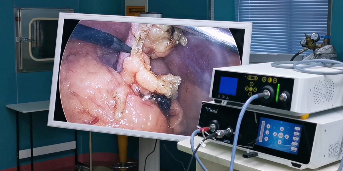 【4K醫用內窺鏡攝像系統】您的第一臺“4K”找到了嗎？