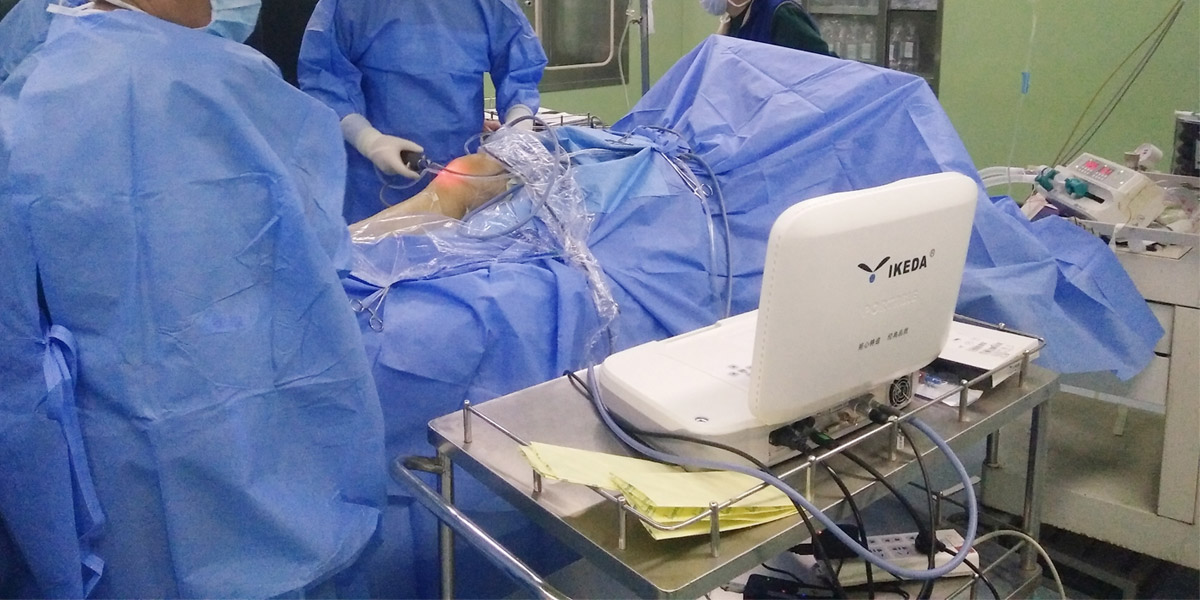 關節鏡下松解術治療膝關節粘連 關節鏡下松解術治療膝關節粘連