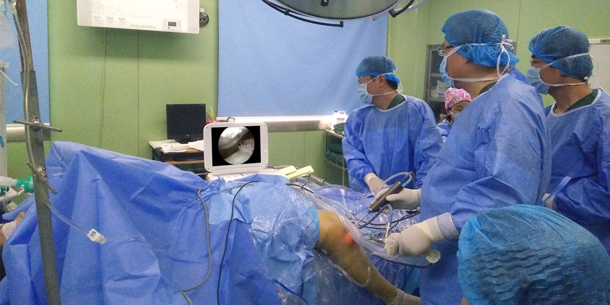 關節鏡下松解術治療膝關節粘連 關節鏡下松解術治療膝關節粘連