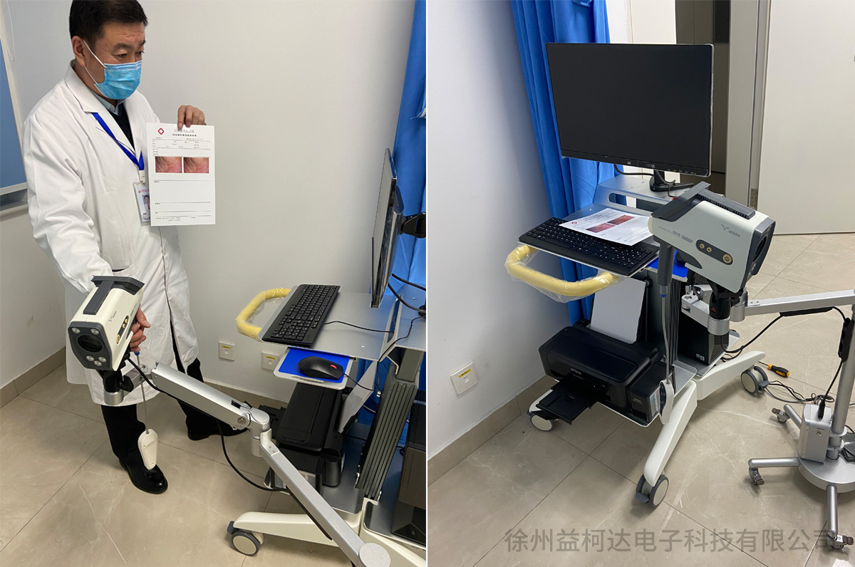 益柯達高清數碼電子陰道鏡裝機 益柯達高清數碼電子陰道鏡裝機