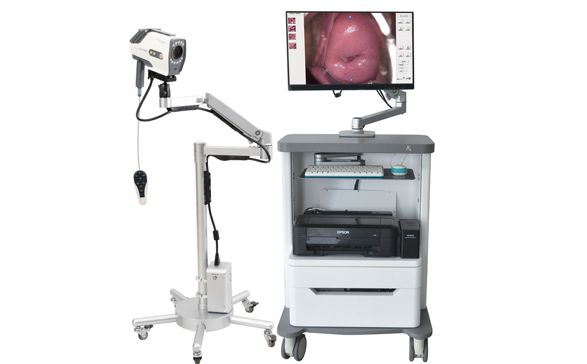 數(shù)碼電子陰道鏡 數(shù)碼電子陰道鏡