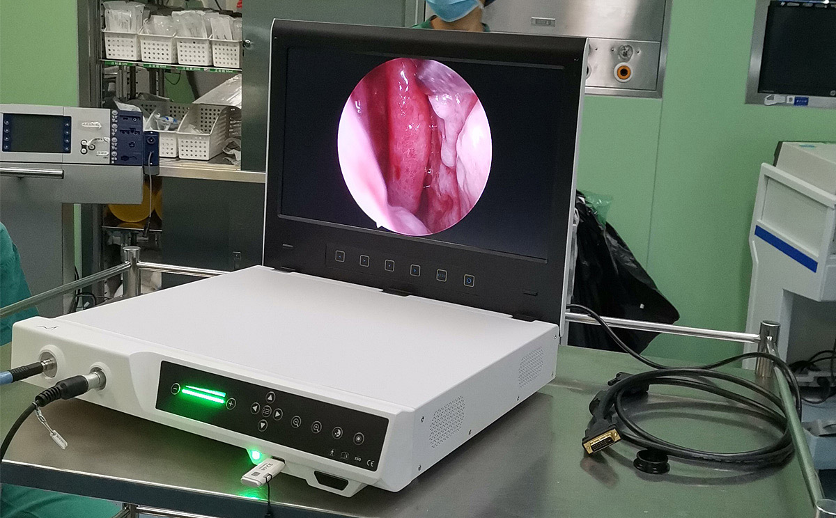 內(nèi)窺鏡攝像系統(tǒng) 內(nèi)窺鏡攝像系統(tǒng)