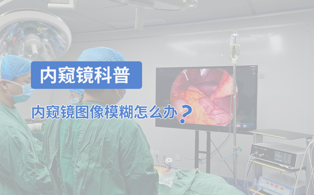 內窺鏡科普:內窺鏡圖像模糊怎么辦? 內窺鏡科普:內窺鏡圖像模糊怎么辦?