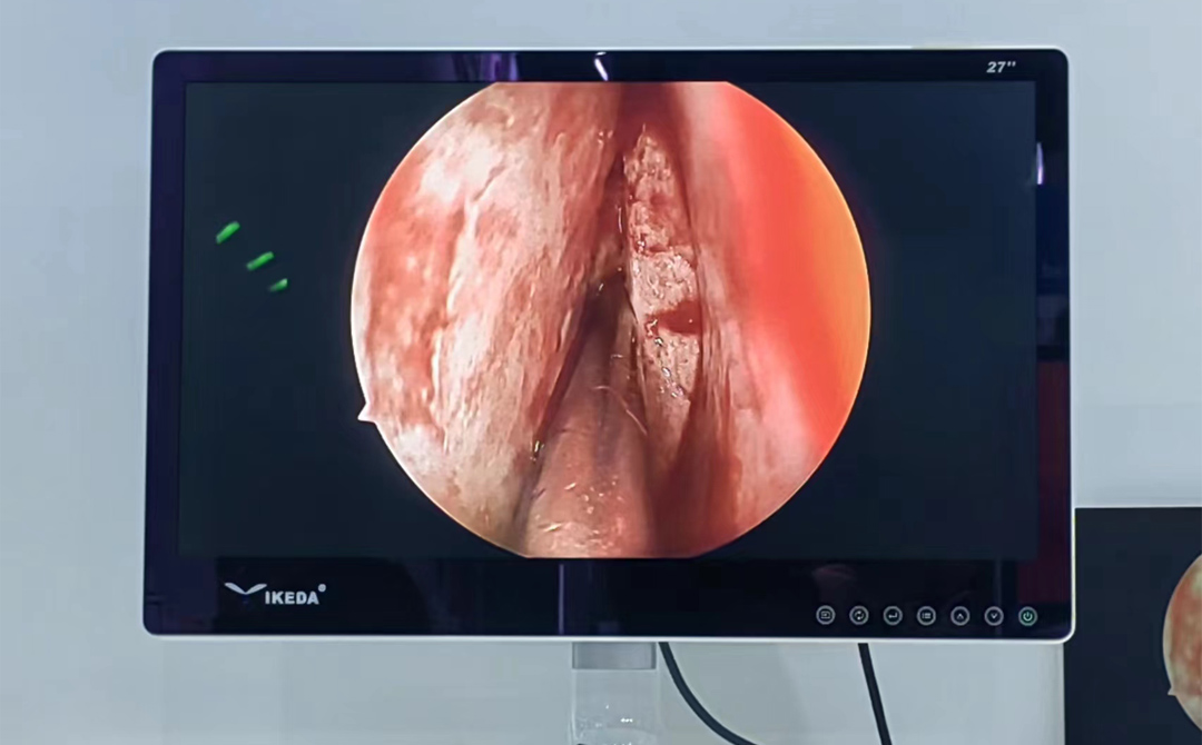 醫用監視器 醫用監視器