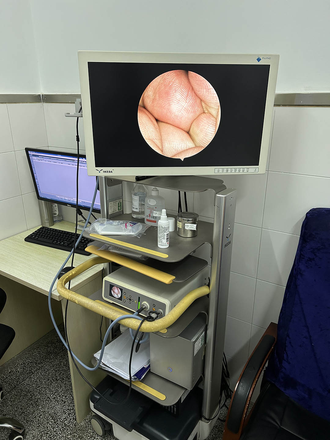 醫用內窺鏡攝像系統 醫用內窺鏡攝像系統