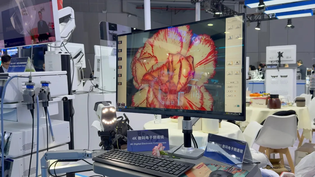 4K數碼電子陰道鏡 4K數碼電子陰道鏡