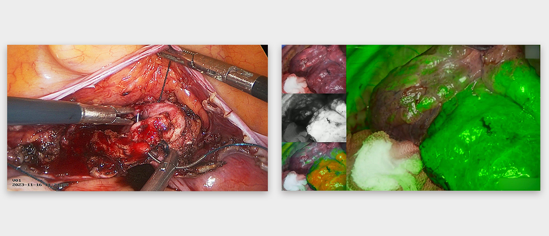 4K熒光內窺鏡攝像系統 4K熒光內窺鏡攝像系統