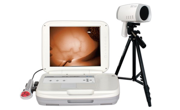 乳腺癌形成原因有哪些？多發(fā)生在哪些群體？