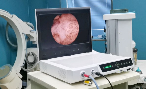 一文了解關節鏡系統的構成、應用、操作流程